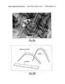 ELECTRICAL-ASSISTED DOUBLE SIDE INCREMENTAL FORMING AND PROCESSES THEREOF diagram and image