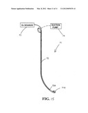 INTUBATION STYLET diagram and image