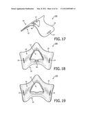 WEARABLE MEDICAL SUPPORT FOR DELIVERY OF FLUIDS TO THE NOSE diagram and image