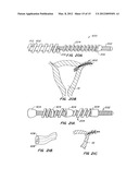 OCCLUSION DEVICES AND METHODS diagram and image