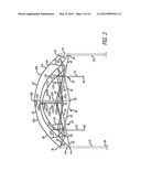 CRAFT DOME diagram and image