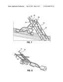 Ladder standoff device diagram and image