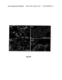 GREEN SYNTHESIS OF NANOMETALS USING PLANT EXTRACTS AND USE THEREOF diagram and image