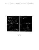 GREEN SYNTHESIS OF NANOMETALS USING PLANT EXTRACTS AND USE THEREOF diagram and image