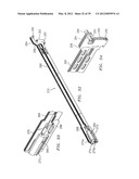 Surgical Stapling Apparatus diagram and image