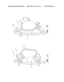 NOSEPAD CONNECTOR FOR EYEWEAR diagram and image