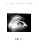 METHOD FOR ANALYZING TEAR FILM THERMOGRAPH OF CONTACTLESS TEAR FILM     THERMAL IMAGER diagram and image