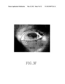 METHOD FOR ANALYZING TEAR FILM THERMOGRAPH OF CONTACTLESS TEAR FILM     THERMAL IMAGER diagram and image