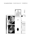 METHOD FOR ANALYZING TEAR FILM THERMOGRAPH OF CONTACTLESS TEAR FILM     THERMAL IMAGER diagram and image