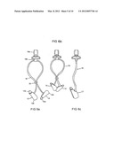 Security and protection device for an ear-mounted audio amplifier or     telecommunication instrument diagram and image