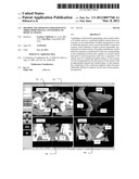 Method and Apparatus for Efficient Three-Dimensional Contouring of Medical     Images diagram and image