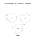 Method and Apparatus for Efficient Three-Dimensional Contouring of Medical     Images diagram and image