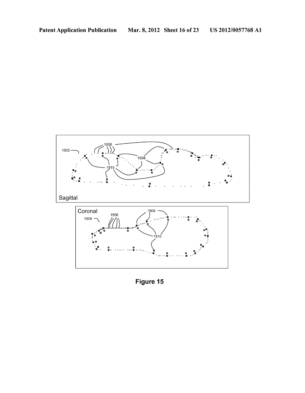 Method and Apparatus for Efficient Three-Dimensional Contouring of Medical     Images - diagram, schematic, and image 17