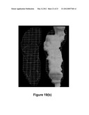 Method and Apparatus for Efficient Three-Dimensional Contouring of Medical     Images diagram and image