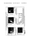 ACTIVATED LEUKOCYTE COMPOSITION AND USES FOR WOUND HEALING diagram and image