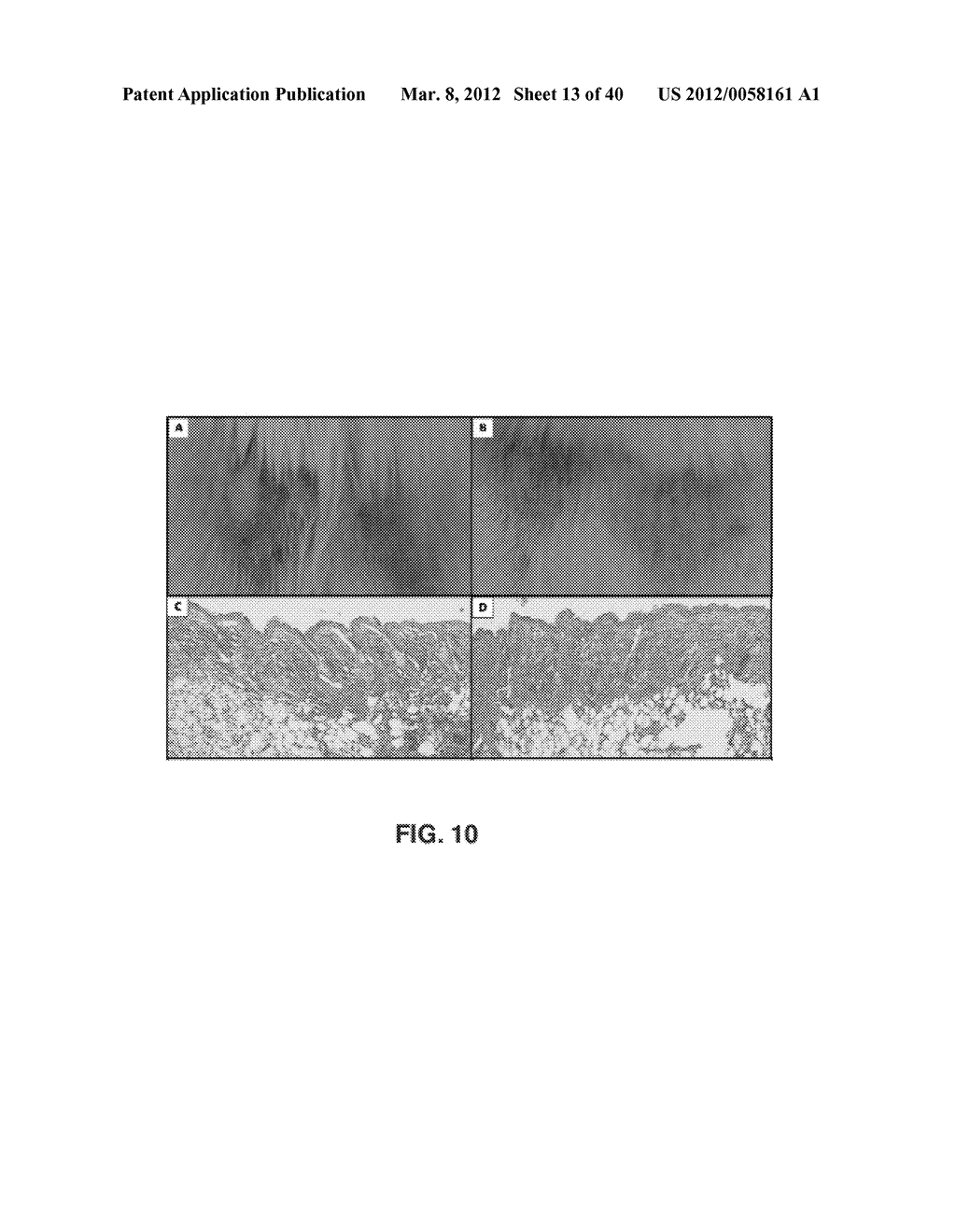 ALKYLATED SEMI SYNTHETIC GLYCOSAMINOGLYCOSAN ETHERS, AND METHODS FOR     MAKING AND USING THEREOF - diagram, schematic, and image 14