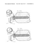  METHOD AND A SYSTEM FOR PRESSURISING AND DISPENSING CARBONATED BEVERAGES diagram and image