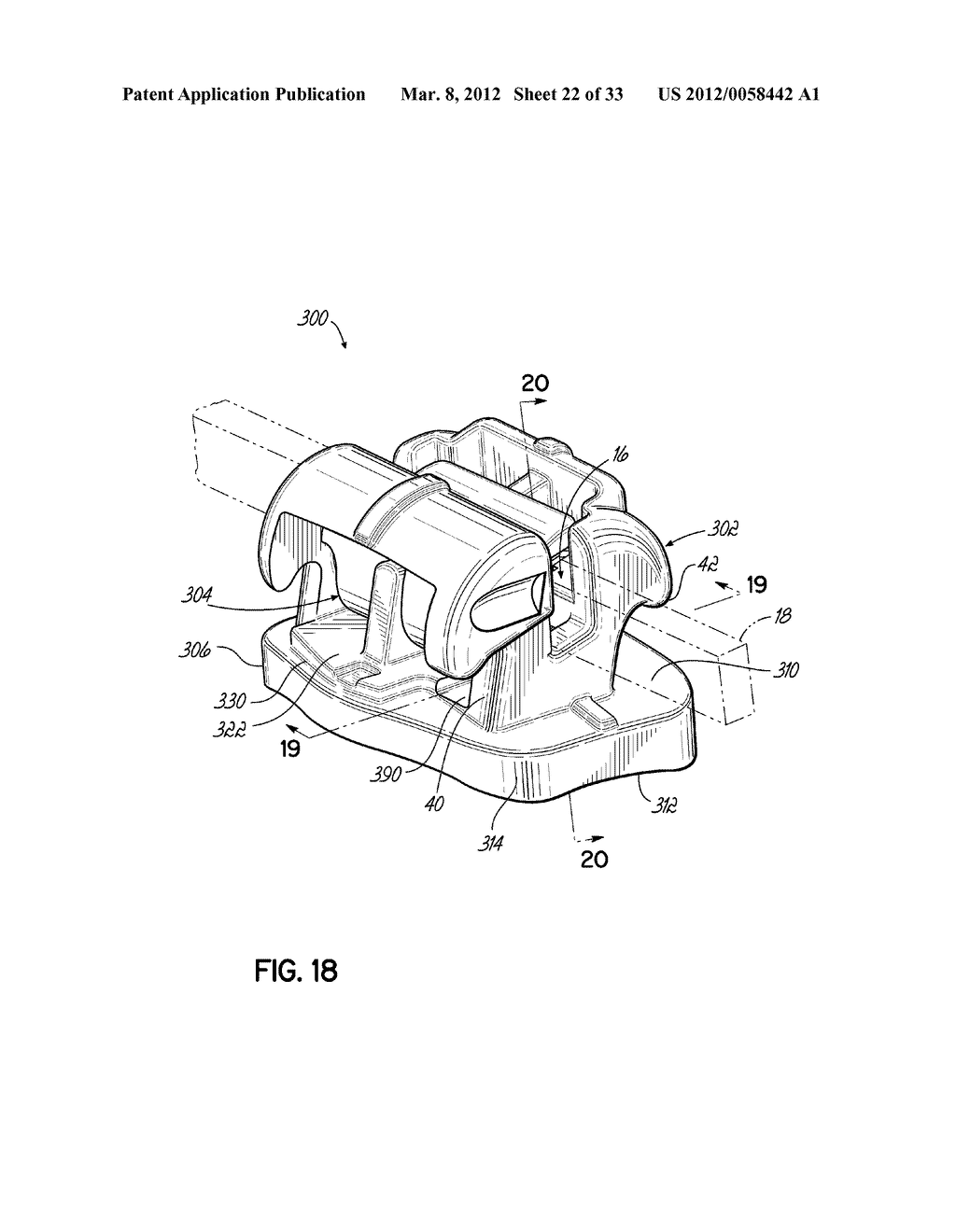 SELF-LIGATING ORTHODONTIC BRACKET AND METHOD OF MAKING SAME - diagram, schematic, and image 23