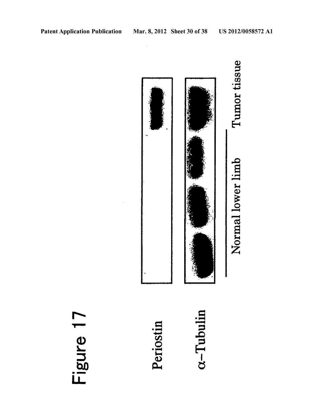 ANTIBODY AGAINST PERIOSTIN, AND A PHARMACEUTICAL COMPOSITION COMPRISING IT     FOR PREVENTING OR TREATING A DISEASE IN WHICH PERIOSTIN IS INVOLVED - diagram, schematic, and image 31