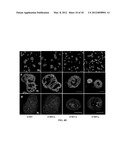 ASSAY FOR THE DETECTION OF RECURRENCE IN BREAST CANCER USING THE NOVEL     TUMOR SUPPRESSOR DEAR1 diagram and image