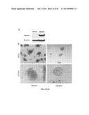 ASSAY FOR THE DETECTION OF RECURRENCE IN BREAST CANCER USING THE NOVEL     TUMOR SUPPRESSOR DEAR1 diagram and image