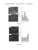 Methods of Treating Neurological Disorders diagram and image