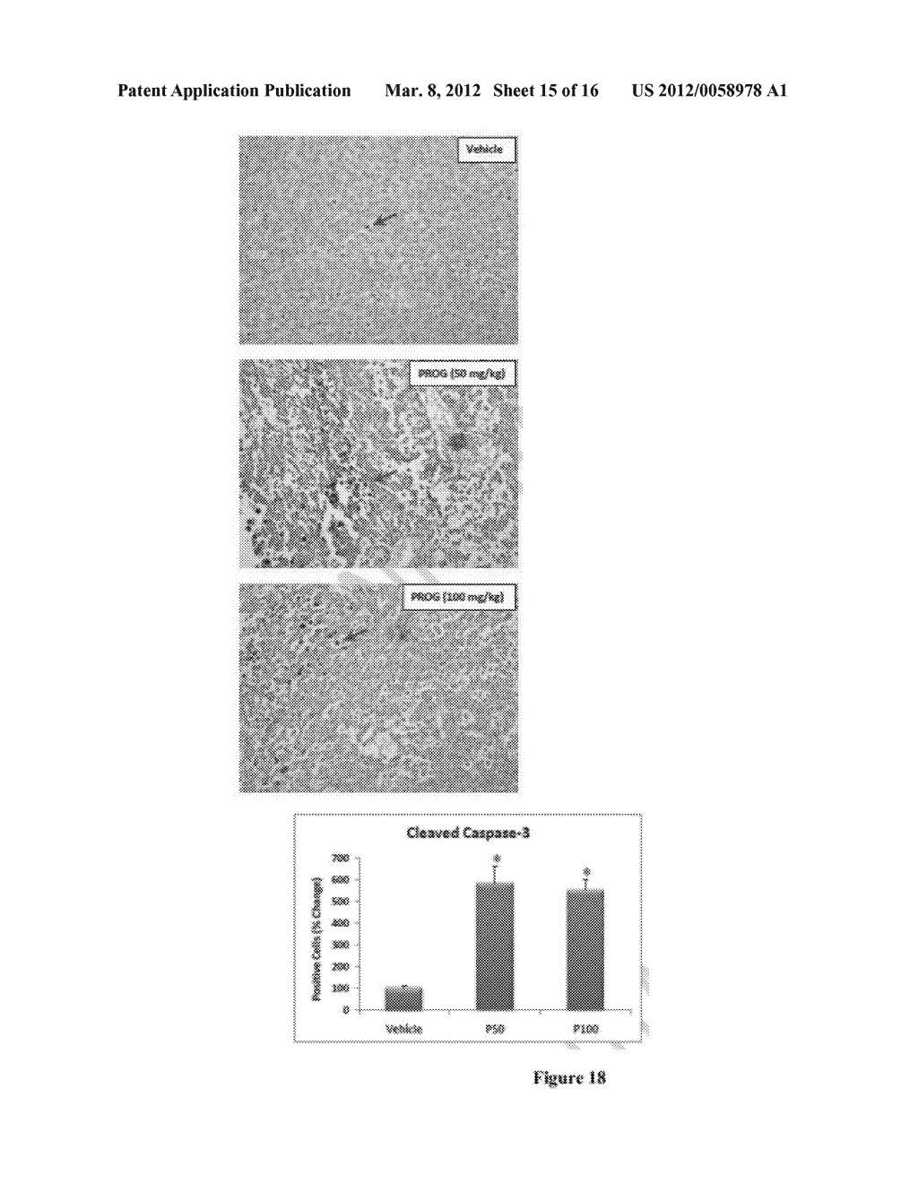 METHOD FOR THE TREATMENT OF CENTRAL NERVOUS SYSTEM CANCERS AND     COMPOSITIONS RELATED THERETO - diagram, schematic, and image 16