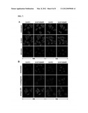 METHODS FOR DIAGNOSING AND TREATING SQUAMOUS CELL CARCINOMA UTILIZING     miRNA-205 AND INHIBITORS THEREOF diagram and image