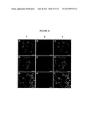 METHODS FOR THE PRODUCTION OF APOLIPOPROTEINS IN TRANSGENIC PLANTS diagram and image