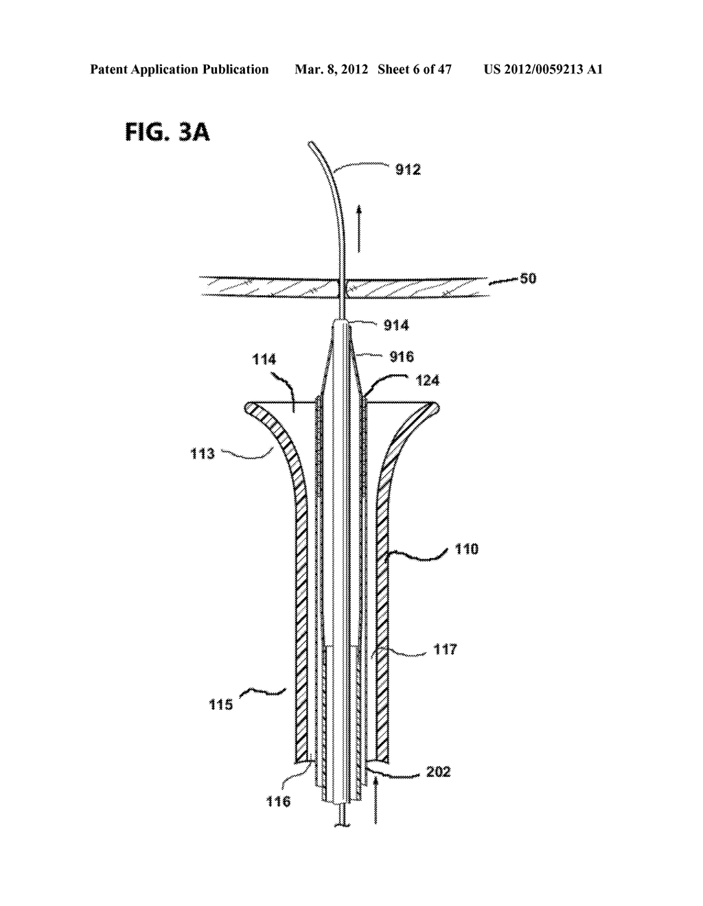 Cannula Systems and Methods - diagram, schematic, and image 07