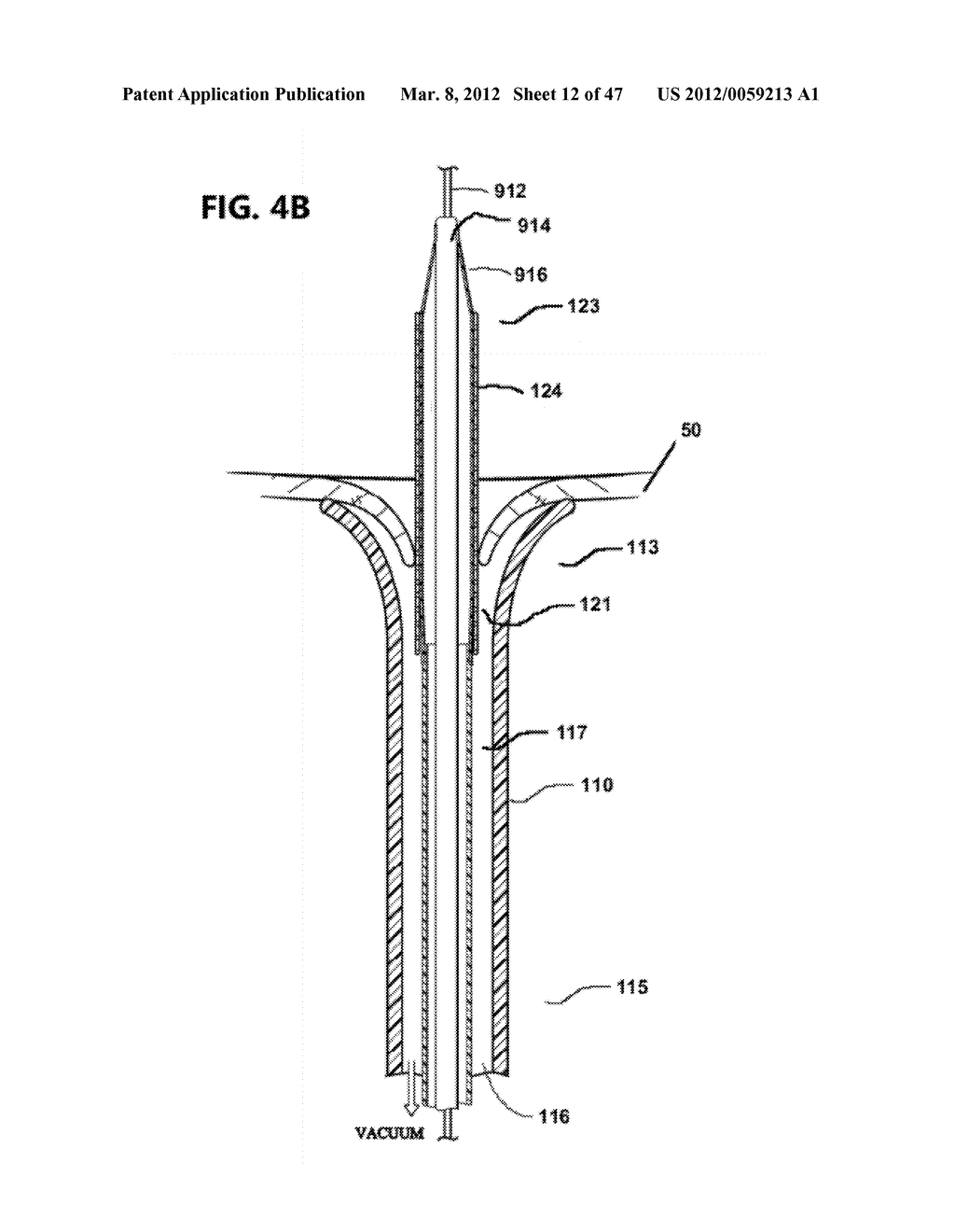 Cannula Systems and Methods - diagram, schematic, and image 13