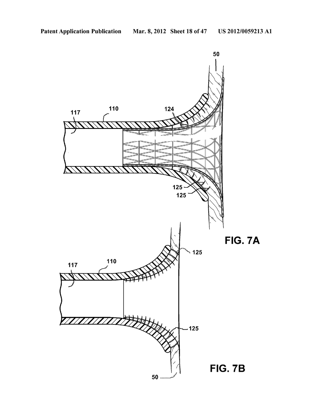 Cannula Systems and Methods - diagram, schematic, and image 19