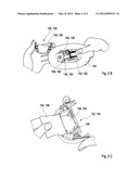 DEVICE FOR PERFORMING AT LEAST ONE MEDICAL FUNCTION diagram and image