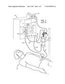 Blood Chamber for an Optical Blood Monitoring System diagram and image