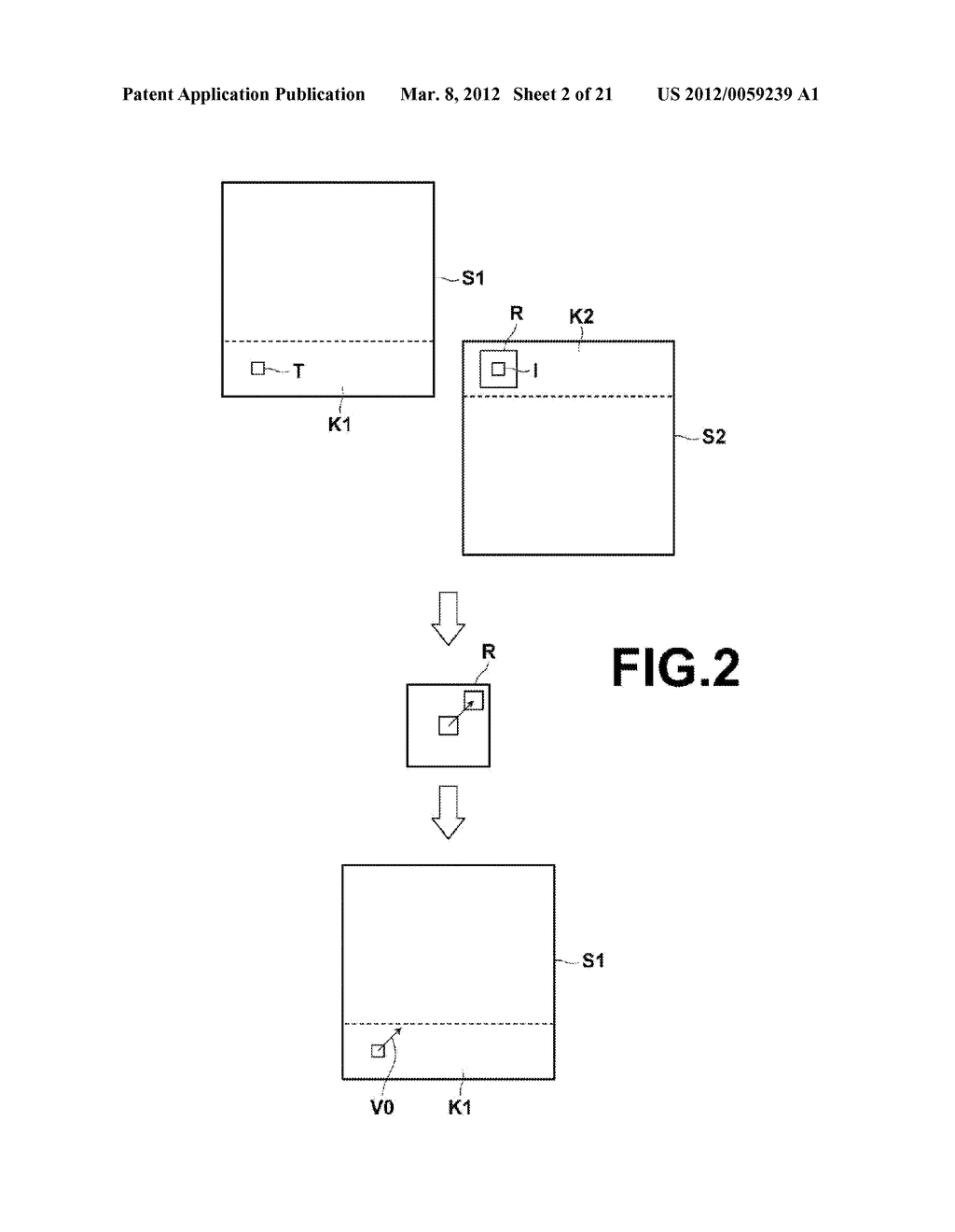 BODY MOTION DETECTION DEVICE AND METHOD, AS WELL AS RADIOGRAPHIC IMAGING     APPARATUS AND METHOD - diagram, schematic, and image 03