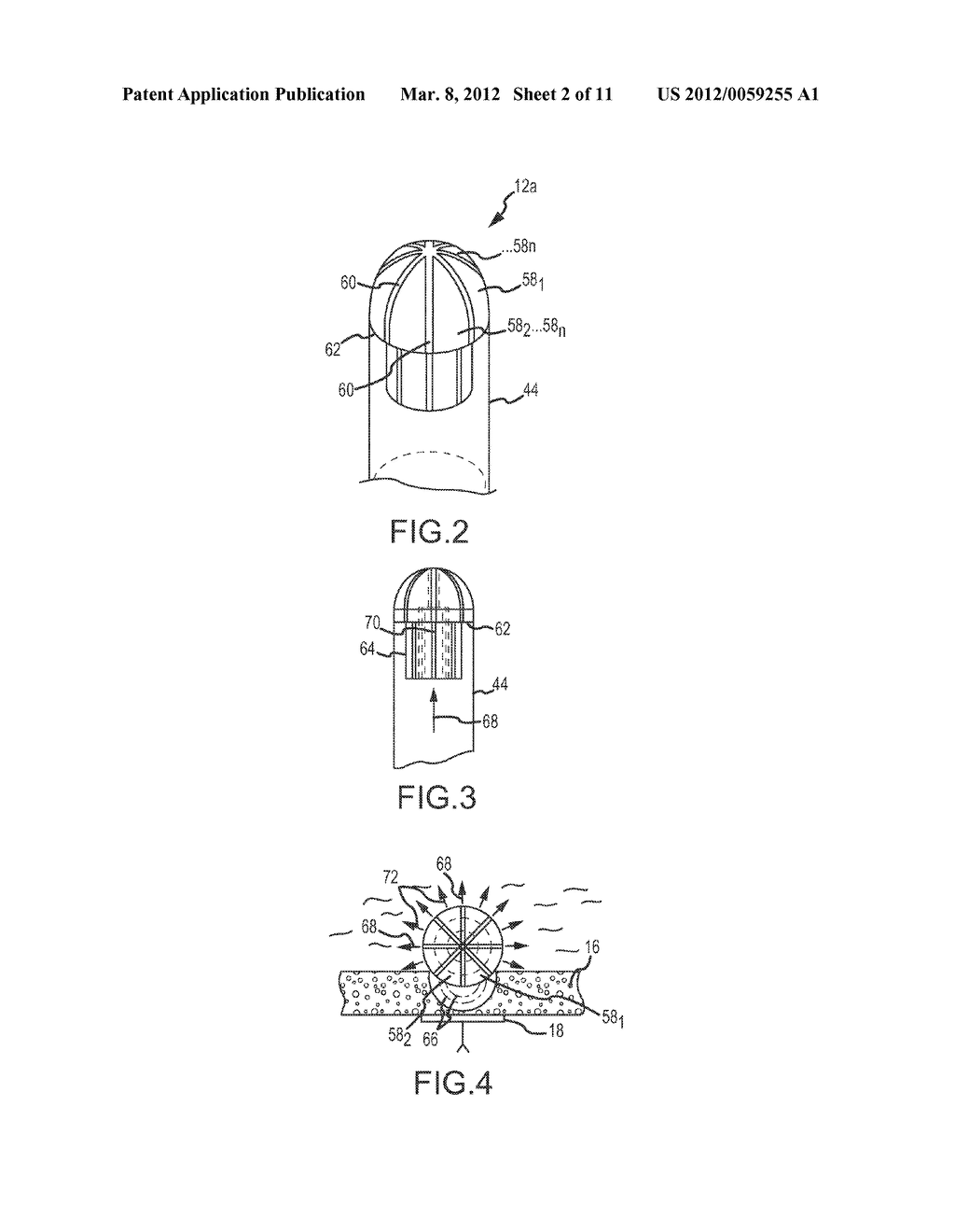 CATHETER SYSTEMS - diagram, schematic, and image 03