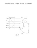 APPARATUS AND METHOD FOR CATHETER NAVIGATION USING ENDOVASCULAR ENERGY     MAPPING diagram and image