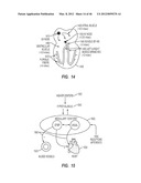 APPARATUS AND METHOD FOR CATHETER NAVIGATION USING ENDOVASCULAR ENERGY     MAPPING diagram and image