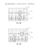 APPARATUS AND METHOD FOR CATHETER NAVIGATION USING ENDOVASCULAR ENERGY     MAPPING diagram and image