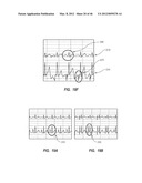 APPARATUS AND METHOD FOR CATHETER NAVIGATION USING ENDOVASCULAR ENERGY     MAPPING diagram and image