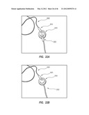 APPARATUS AND METHOD FOR CATHETER NAVIGATION USING ENDOVASCULAR ENERGY     MAPPING diagram and image