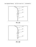 APPARATUS AND METHOD FOR CATHETER NAVIGATION USING ENDOVASCULAR ENERGY     MAPPING diagram and image