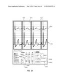 APPARATUS AND METHOD FOR CATHETER NAVIGATION USING ENDOVASCULAR ENERGY     MAPPING diagram and image