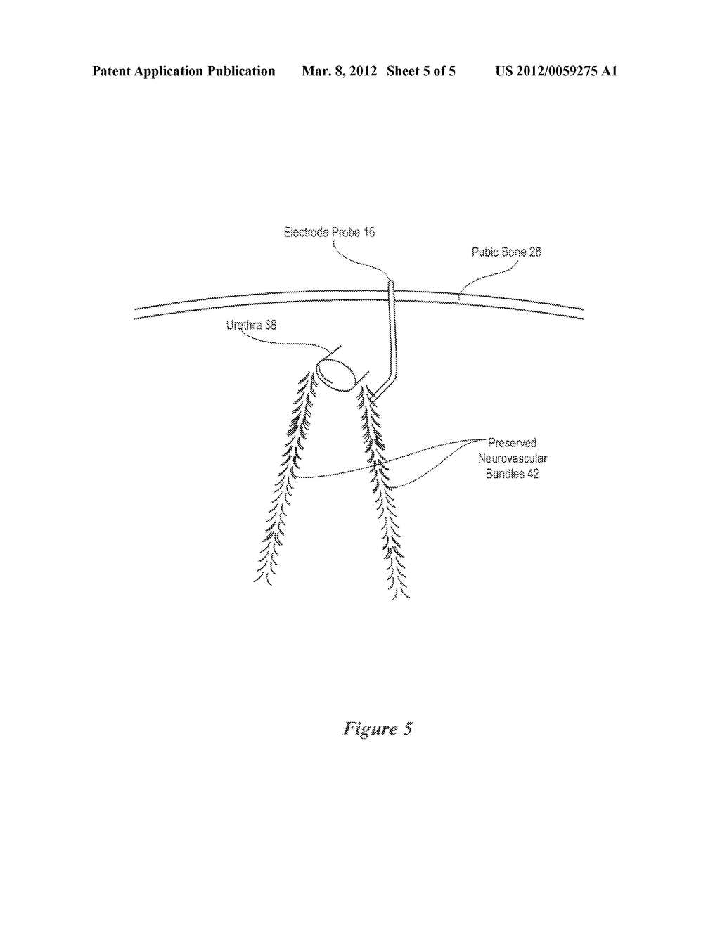 Method for Laparoscopic Nerve Detection and Mapping - diagram, schematic, and image 06