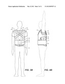 SCAPULO-SPINAL STABILIZER WITH ABDOMINAL SUPPORT FOR OPENING THE SUPERIOR     THORACIC APERTURE diagram and image