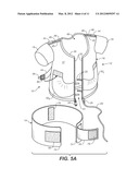 SCAPULO-SPINAL STABILIZER WITH ABDOMINAL SUPPORT FOR OPENING THE SUPERIOR     THORACIC APERTURE diagram and image