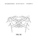 SCAPULO-SPINAL STABILIZER WITH ABDOMINAL SUPPORT FOR OPENING THE SUPERIOR     THORACIC APERTURE diagram and image