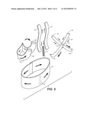 SCAPULO-SPINAL STABILIZER WITH ABDOMINAL SUPPORT FOR OPENING THE SUPERIOR     THORACIC APERTURE diagram and image