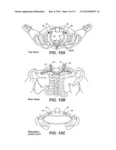 SCAPULO-SPINAL STABILIZER WITH ABDOMINAL SUPPORT FOR OPENING THE SUPERIOR     THORACIC APERTURE diagram and image