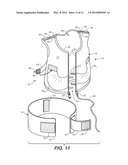 SCAPULO-SPINAL STABILIZER WITH ABDOMINAL SUPPORT FOR OPENING THE SUPERIOR     THORACIC APERTURE diagram and image